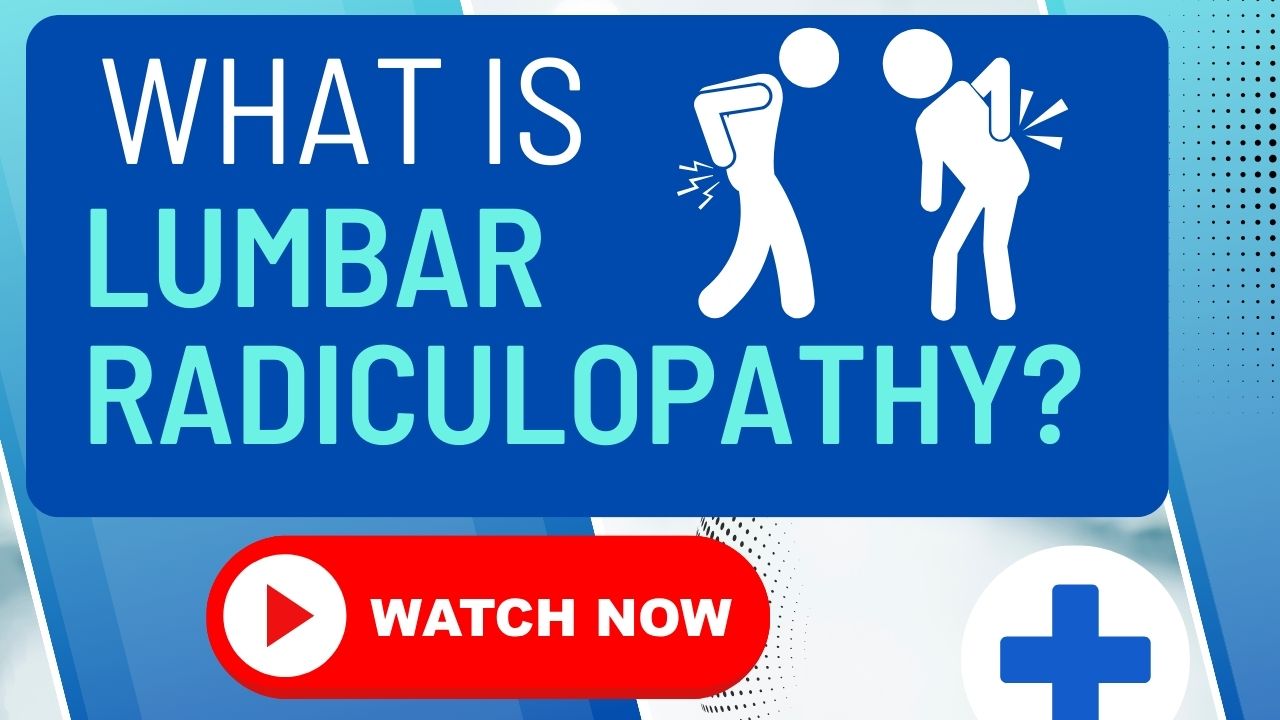 An anatomical model of the lumbar spine with a herniated disc pressing on a nerve root.