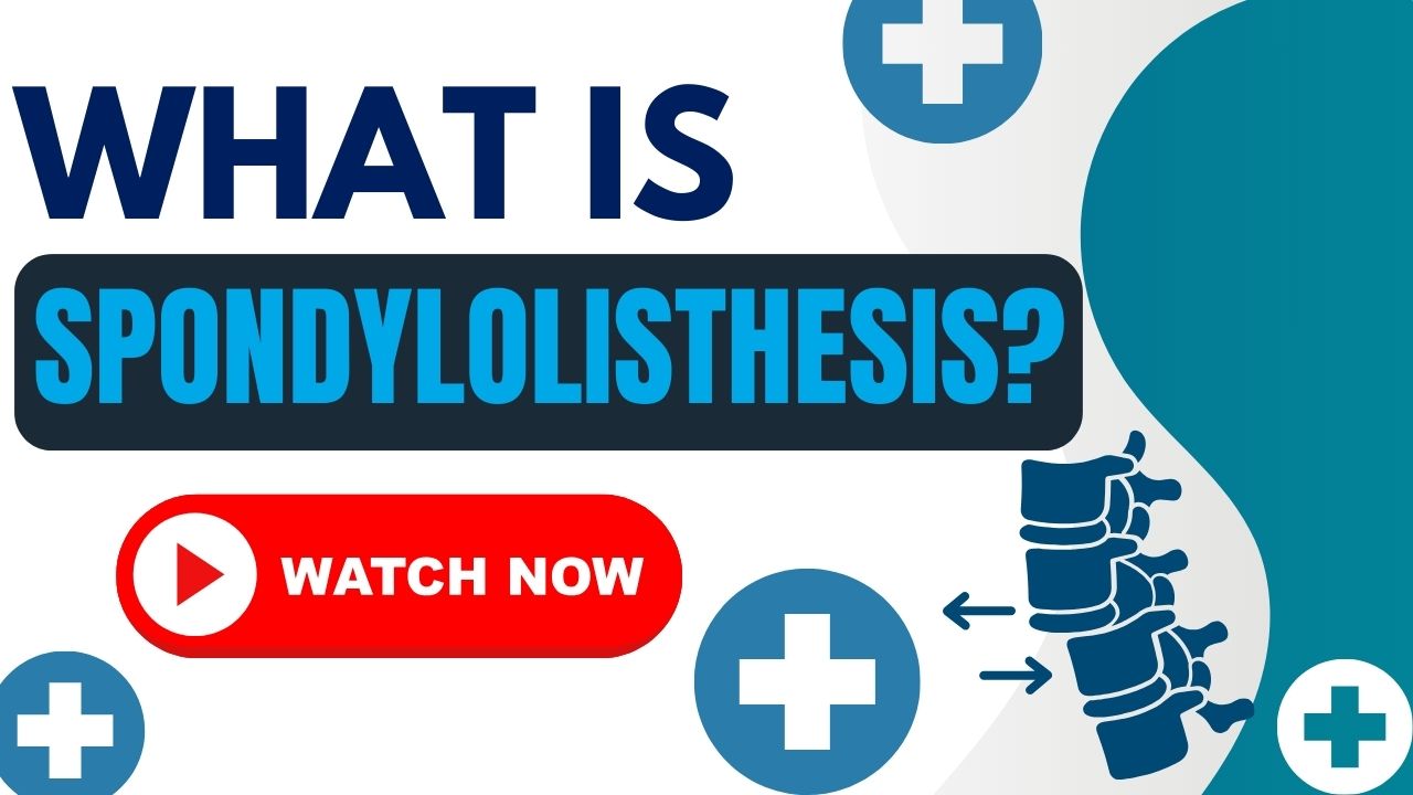 What is Spondylolisthesis? - Educational video about vertebral slippage