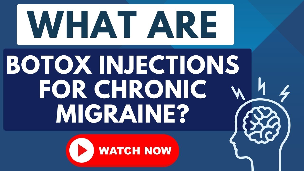 Medical illustration showing the injection sites for chronic migraine Botox treatment