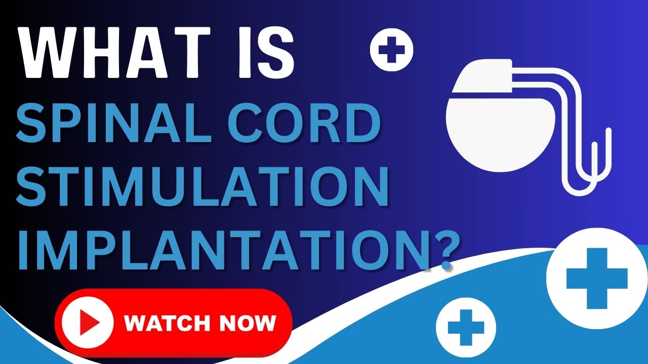 Medical illustration showing a fully implanted spinal cord stimulator system