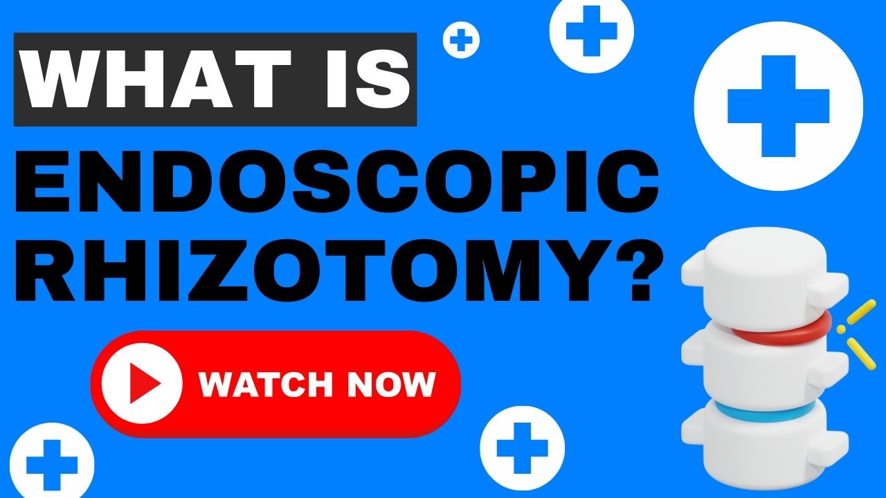 Endoscopic Rhizotomy