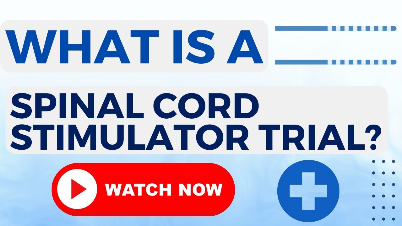 Medical illustration showing spinal cord stimulator leads placed in the epidural space
